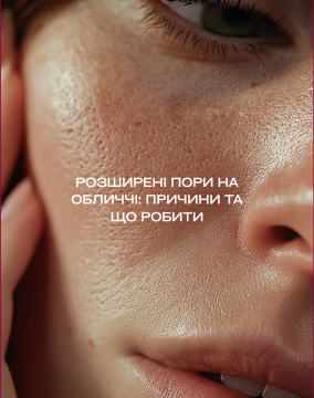 Розширені пори на обличчі: причини та що робити
