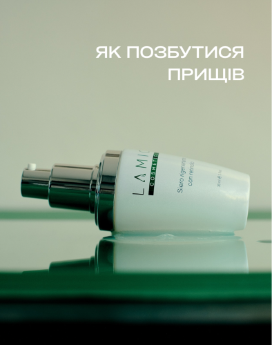 Як позбутися прищів