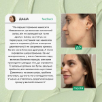 Сироватка для обличчя з проявами акне  від Lamic "Siero per il viso con sintomi di acne", 50ml