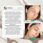 Сироватка для обличчя з проявами акне  від Lamic "Siero per il viso con sintomi di acne", 50ml